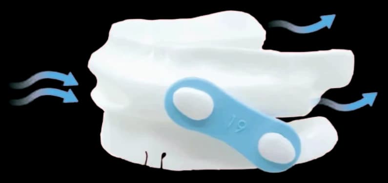 PEEP Guard sleep apnoea device with arrows showing air flowing through it